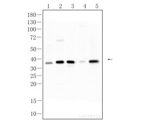 Cdk6 Recombinant Rabbit Monoclonal Antibody