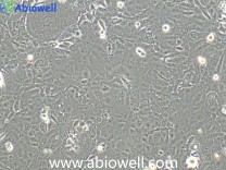 DU145 (人前列腺癌细胞)（STR鉴定）