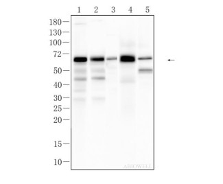 NFkB p65 Mouse Monoclonal Antibody