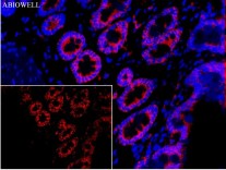 SQSTM1/p62 Mouse Monoclonal Antibody