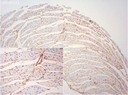 Collagen III Mouse Monoclonal Antibody