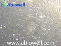 人主动脉瓣膜间质细胞永生化（IF鉴定）