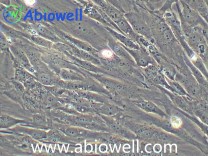 人原代骨骼肌细胞永生化细胞（IF鉴定）